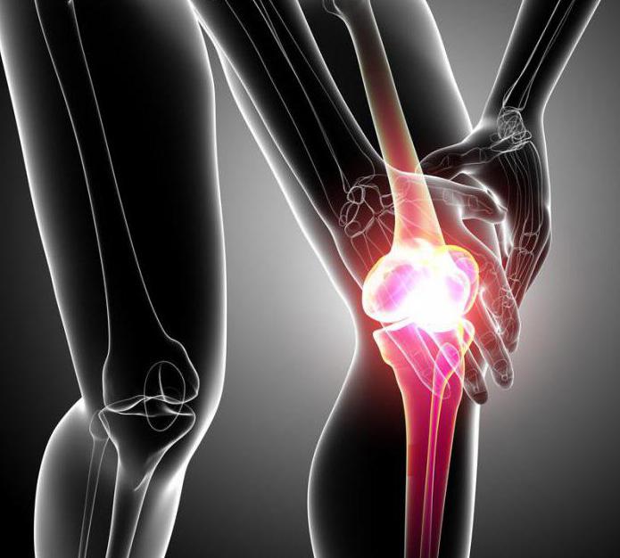 tretman artroze koljena trećeg stupnja