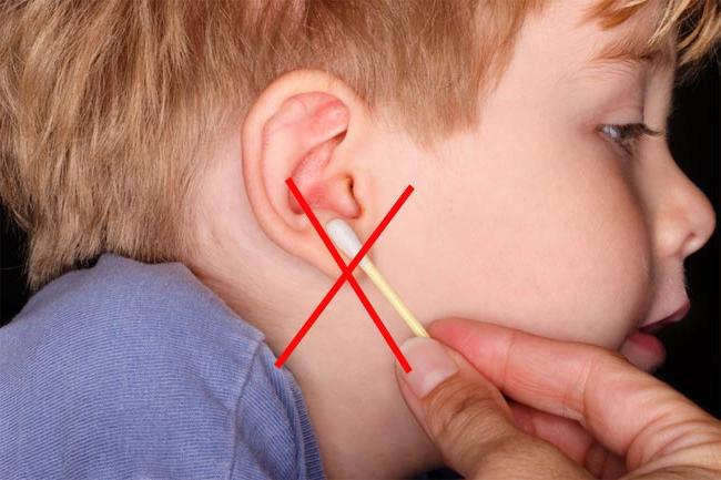 Nekoliko savjeta kako ukloniti sumporni utikač iz uha